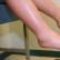 מדוע הרגליים מתנפחות בקרסוליים ובקרסוליים של הרגליים אצל נשים בהריון: סיבות ודרכי טיפול